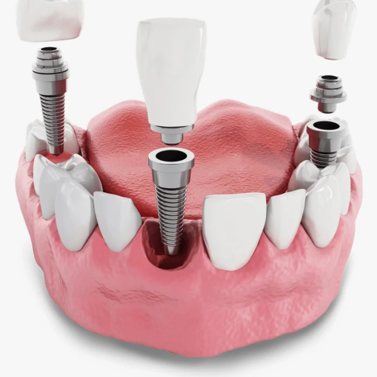 resim_2025-04-27_131808612